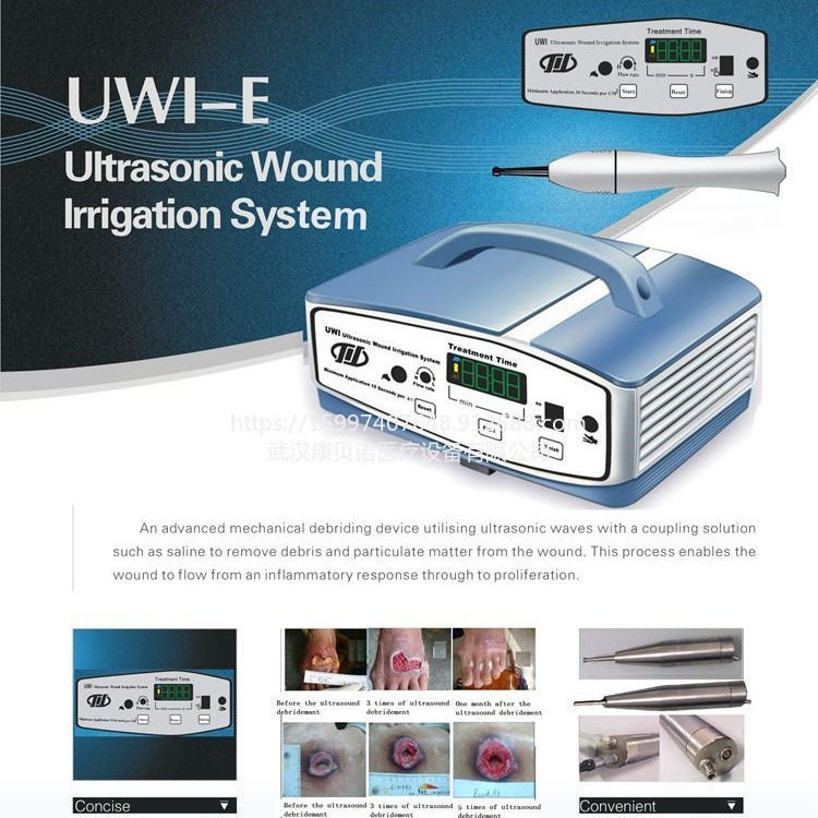 医用超声清创机 多功能超声能清创仪 清创机UWI-I