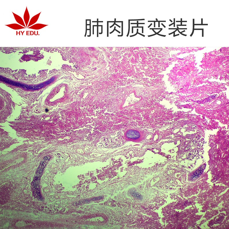 肺肉质变装片  高教标准 显微镜玻片 病理组织细胞 生物切片 成像清晰
