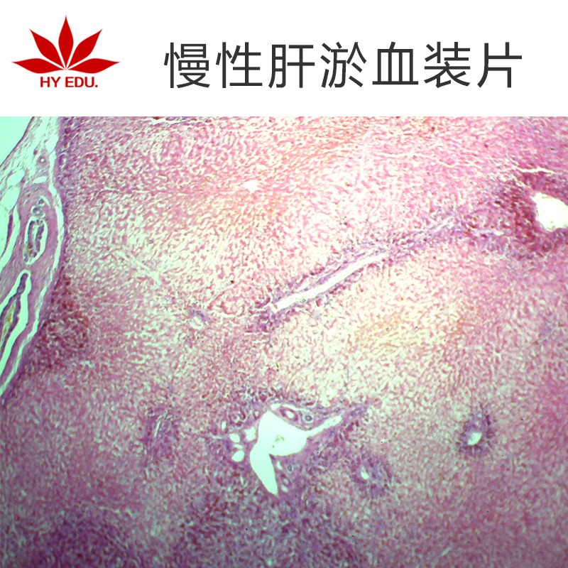 慢性肝淤血装片  高教标准  显微镜玻片 病理组织细胞 生物切片 成像清晰